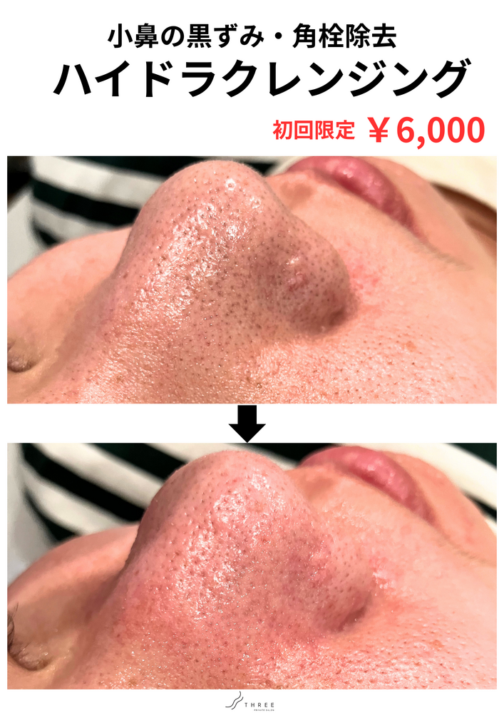 画像15373