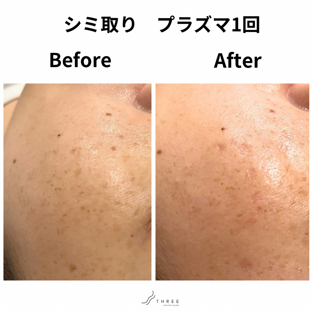 画像16311