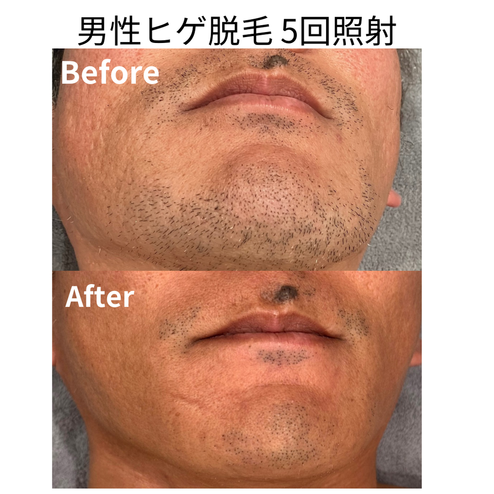 画像17254