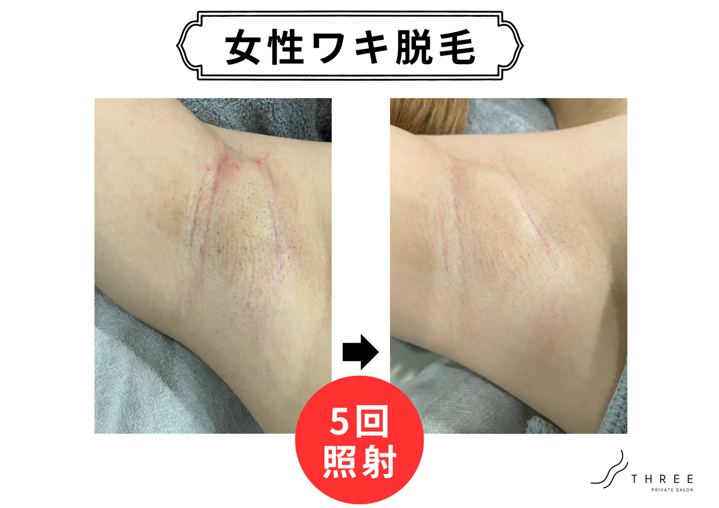 画像20610