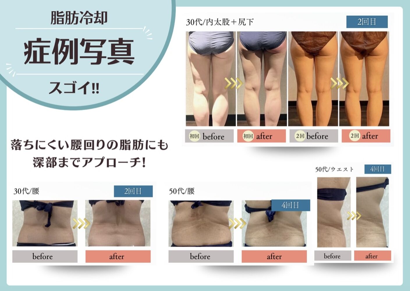 画像20636