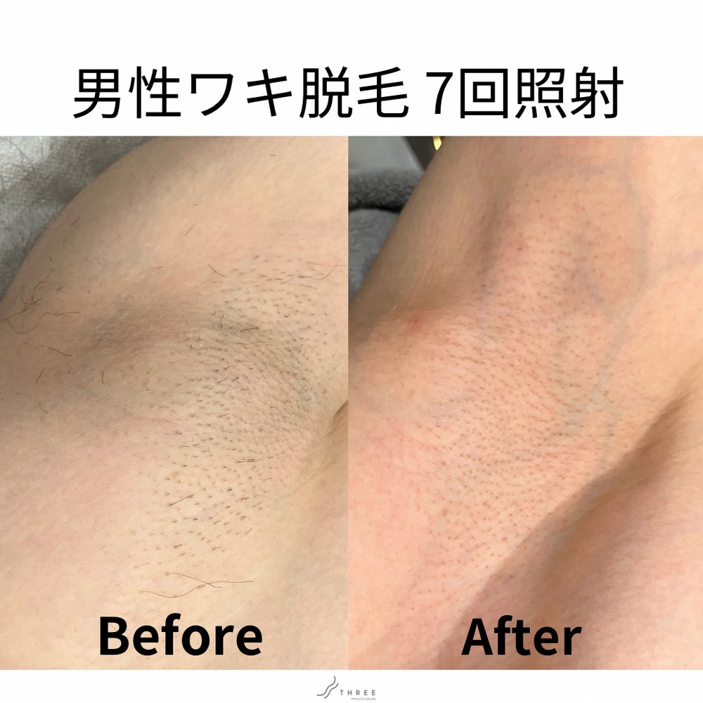 画像26821