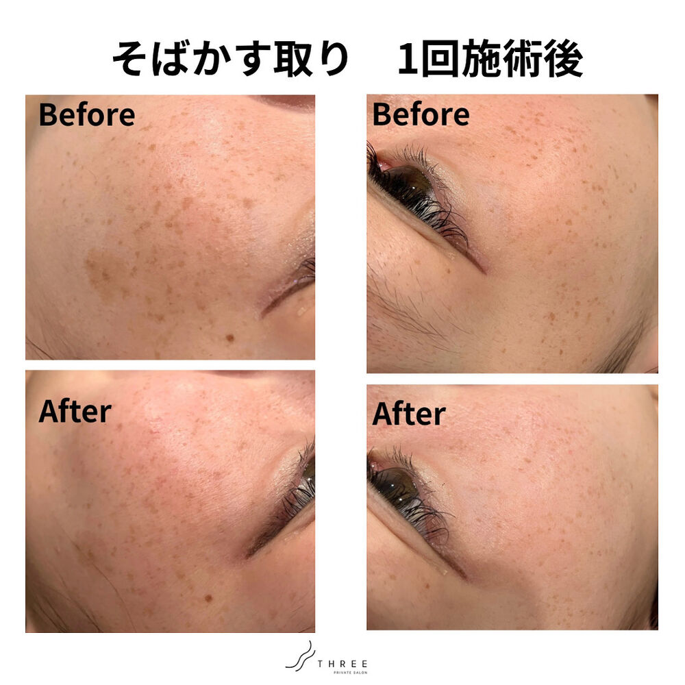 画像27893