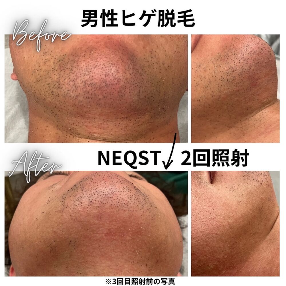 画像4397